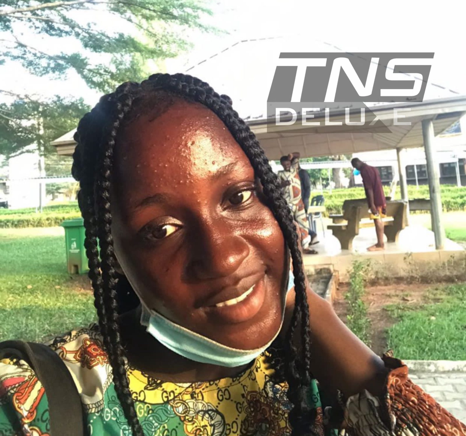 Image a pretty young lady before using tns skin care products